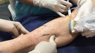 Photo of Dr. Jordan Garrison –  A Hackensack, NJ Vein Doctor That Patient’s Trust