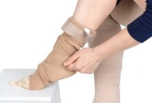 Photo of Lymphedema Patients Should Use Compression Garments