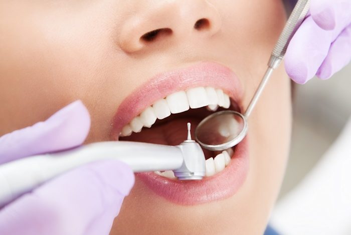 Photo of Various Types Of Dental Fillings | Detailed Knowledge