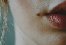 Photo of Lips Reduction Surgery: What You Must Learn Before Doing It