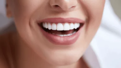 Photo of Regular Teeth Whitening in North Vancouver: Maintaining Optimal Oral Health