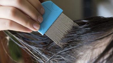 Photo of Effective Lice Treatment: What Virginia Residents Need to Know