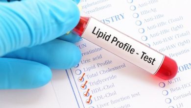 Photo of The Impact of Lipid Profile Testing on Routine Health Check-ups: Cost Considerations