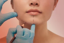Photo of The Impact of Social Media on Plastic Surgery Trends