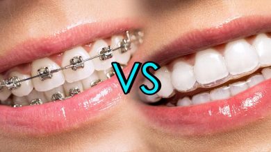 Photo of Invisalign vs. Braces – Unveiling the Pros and Cons