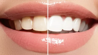 Photo of Pearl Perfection: The Perks Of Teeth Whitening