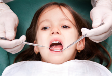 Photo of Advantages of Dental Fillings for Young People
