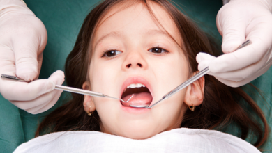 Photo of Advantages of Dental Fillings for Young People