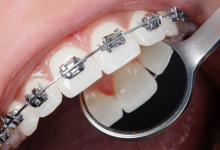 Photo of The Science Behind Orthodontic Treatments: How Modern Technology Shapes Smiles