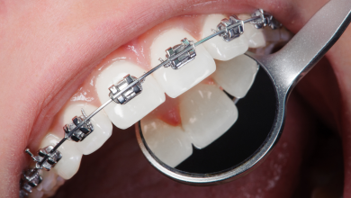 Photo of The Science Behind Orthodontic Treatments: How Modern Technology Shapes Smiles