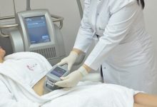 Photo of CoolSculpting: The Leading Non-Surgical Fat Reduction Solution