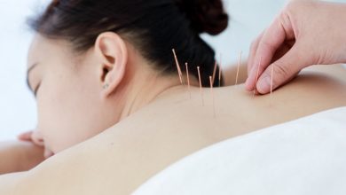 Photo of How Acupuncture Supports Stress Relief and Relaxation