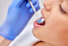 Sealants for Kids: Are They Worth It?